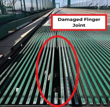 IMAGE SHOWING DAMAGED FINGER JOINT